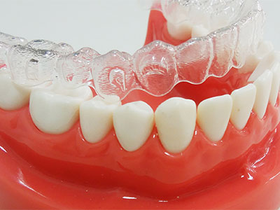 歯にかかる負担が少なく、痛みを最小限に抑える