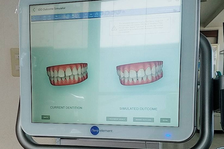 シミュレーション